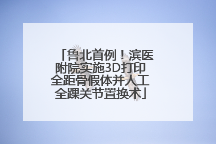 鲁北首例！滨医附院实施3D打印全距骨假体并人工全踝关节置换术